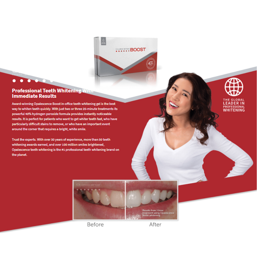 Opalescence Boost %40 PF Ameri - Teeth Whitening Opalescence incelemesi ve fiyatı