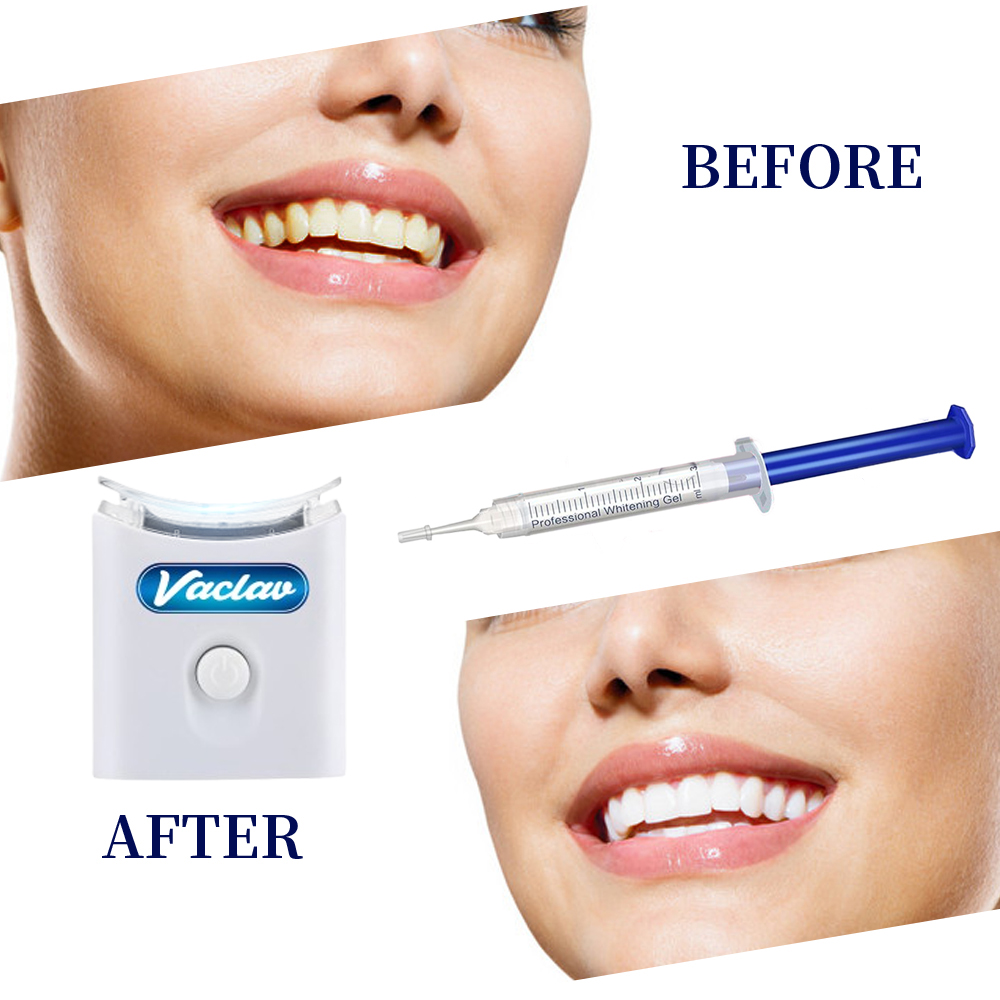 Nane Diş Beyazlatma Jeli Şırın - Teeth Whitening Opalescence incelemesi ve fiyatı
