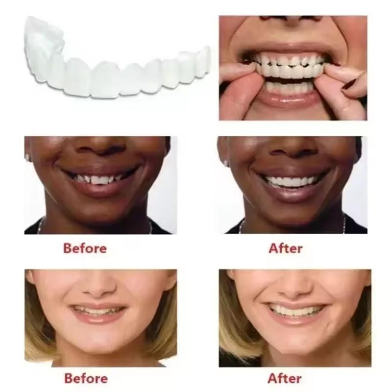 Diş Kaplamaları Beyazlatma Pro - Teeth Whitening Kit incelemesi ve fiyatı