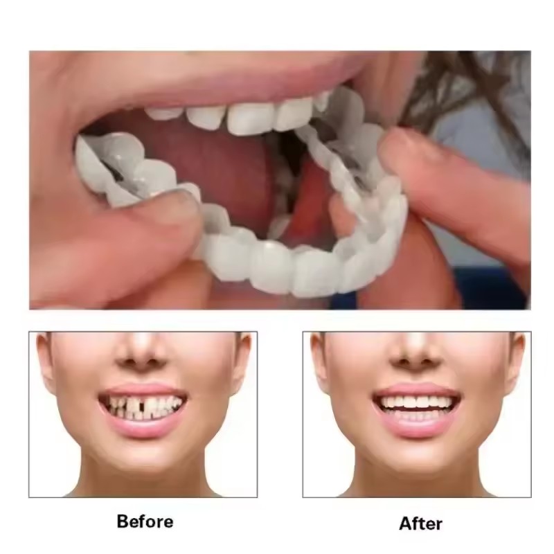 Diş Kaplamaları Beyazlatma Pro - Teeth Whitening Kit incelemesi ve fiyatı